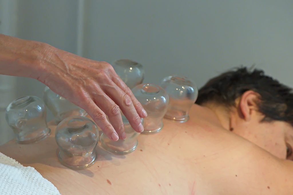 Séance de ventouses